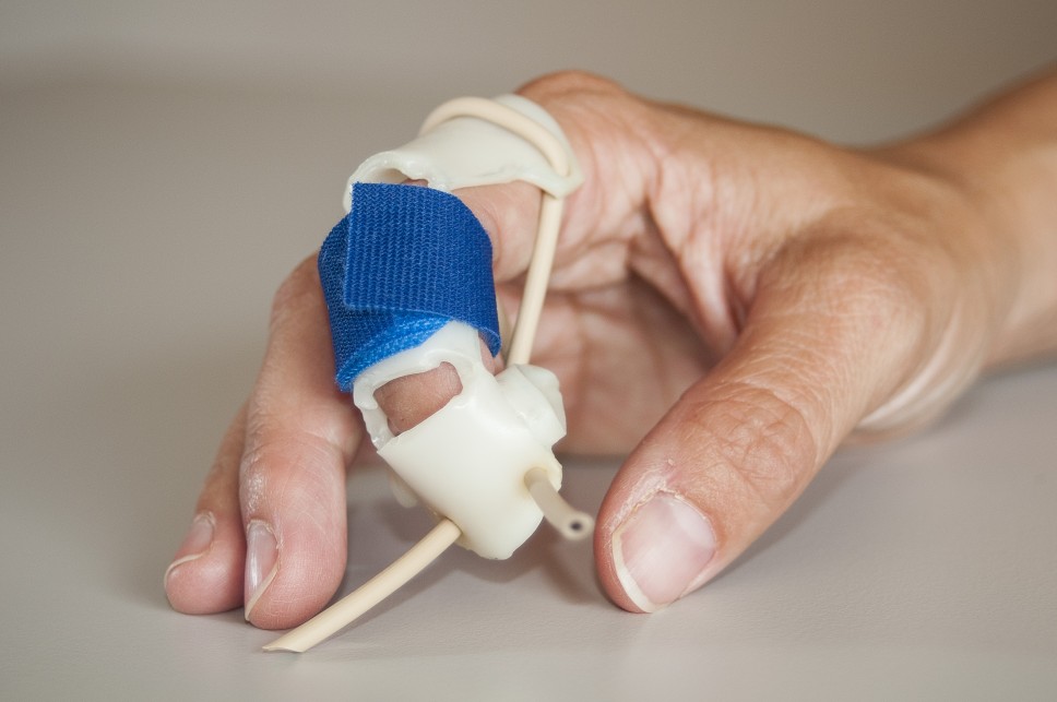 Handtherapie - Dynamische Fingerschiene